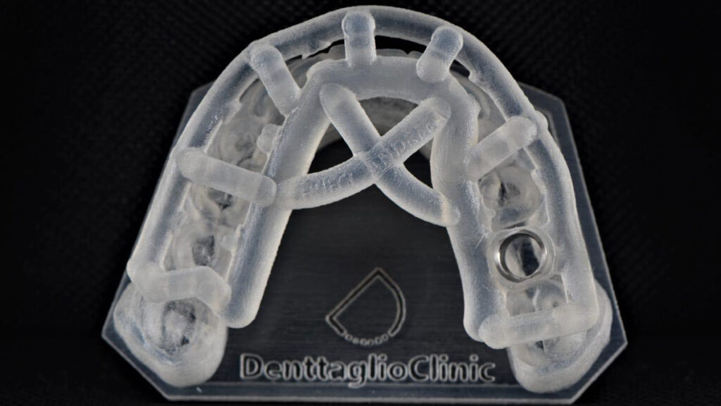 implant dentar ghidat digital