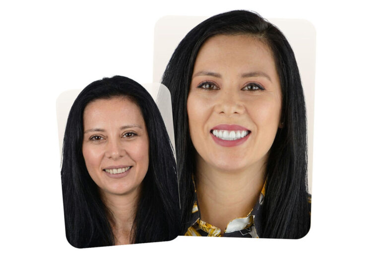 Fațete & Stomatologie Estetică