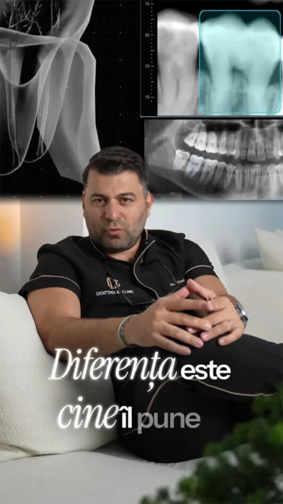 Implanturile nu sunt la fel
