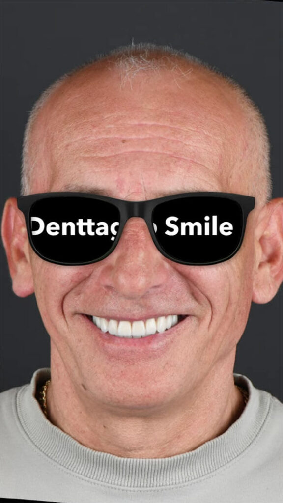 Before/After